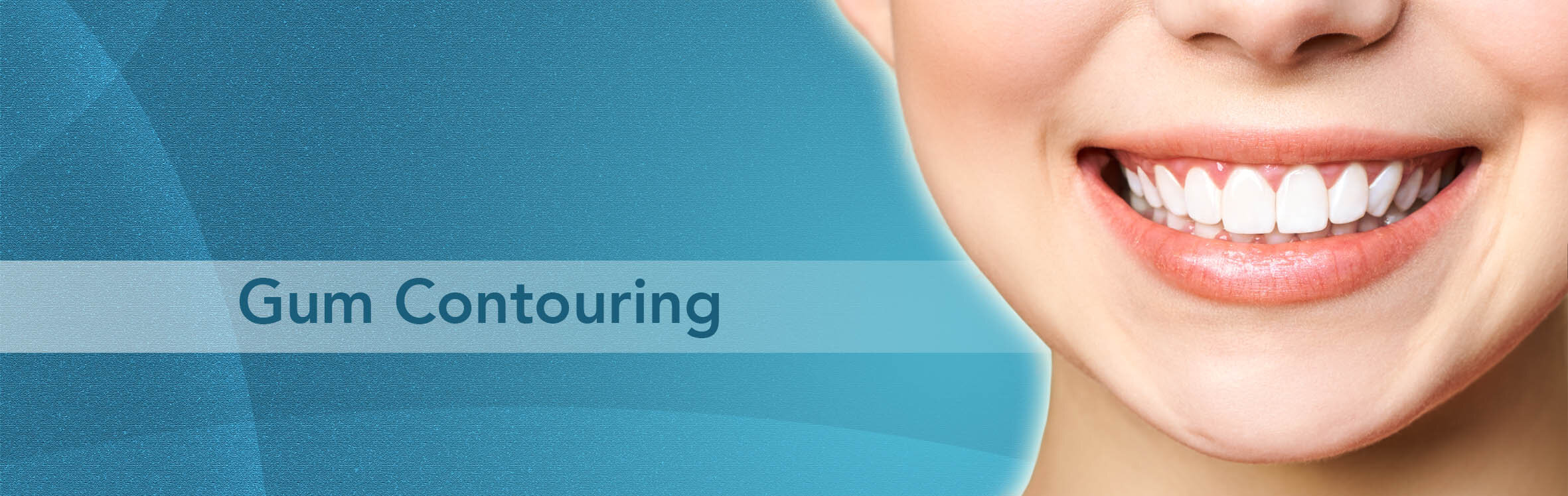 tandkott-konturering