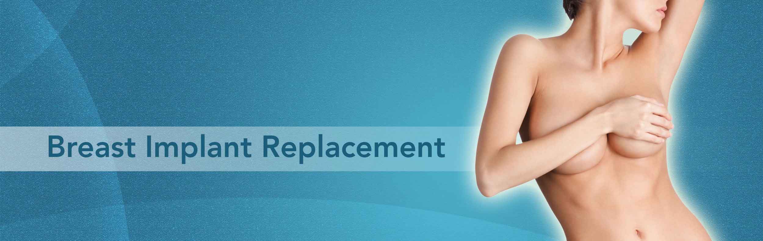 byte-av-brostimplantat